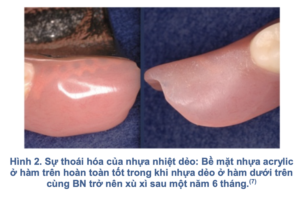 Hàm nhựa dẻo trong phục hình tháo lắp: Đặc tính, chỉ định và biến chứng lâm sàng